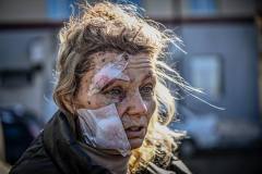 kijev-i-ukrajina-stradavanje-civila-10